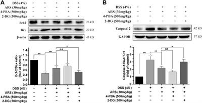 The Inhibitory Effect of Artesunate on Excessive Endoplasmic Reticulum Stress Alleviates Experimental Colitis in Mice